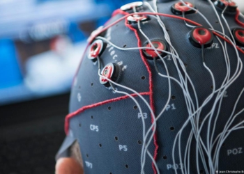 Neuralink Telepathy 2 nâng cấp băng thông vi điện cực và khả năng xử lý tín hiệu thần kinh trực tiếp