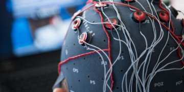 Neuralink Telepathy 2 nâng cấp băng thông vi điện cực và khả năng xử lý tín hiệu thần kinh trực tiếp